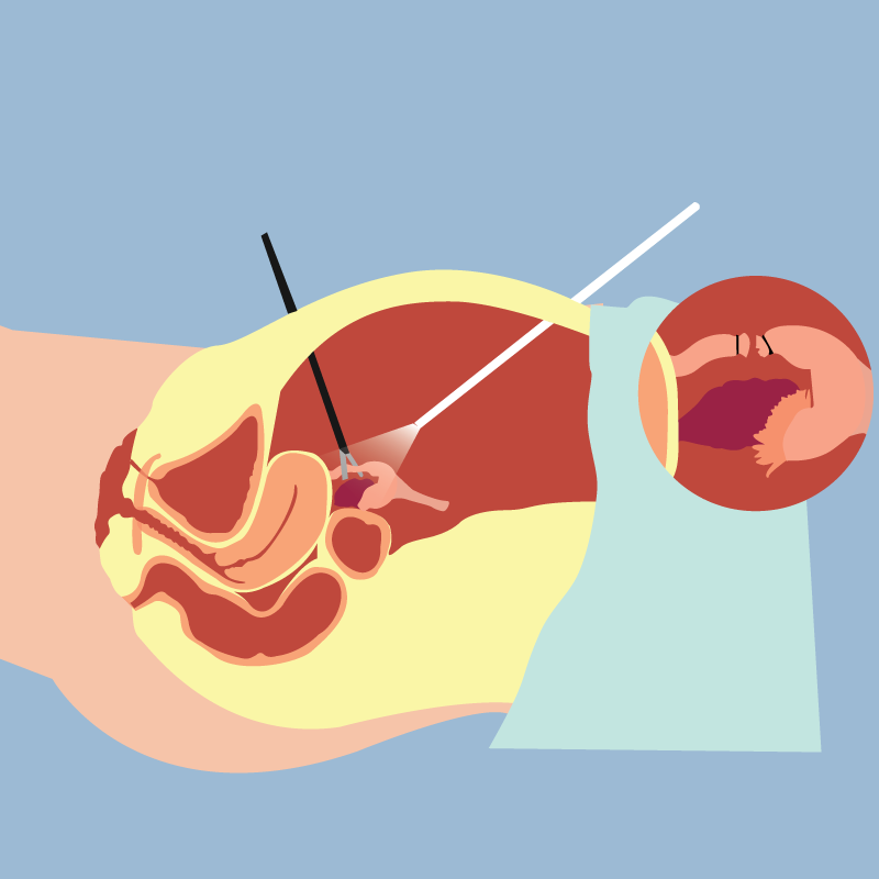 Cirurgia por vídeo