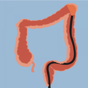 Colonoscopia: realidade vs expectativas